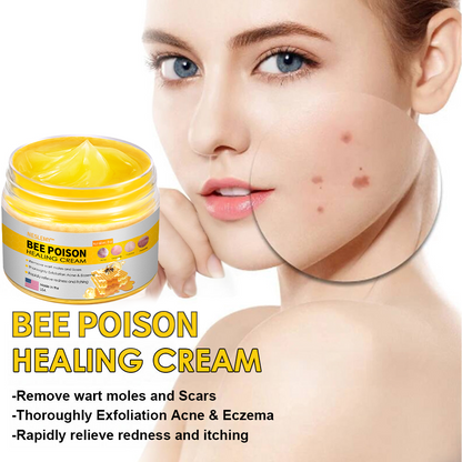 NESLEMY™ Bee Venom Skin Cream（👨‍⚕BAD Recommended),for Remove Warts, Acne and Scars