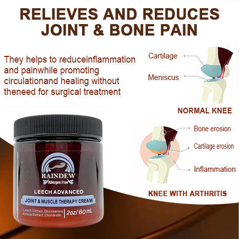 Raindew™ Leech Advanced Joint & Muscle Therapy Cream - specializing in orthopedic conditions