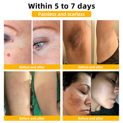 One Time Offer！Transform Your Health Today！We are offering you an additional 30% off! Dermatologist tested and completely cures all types of healthy in 3-6 weeks!