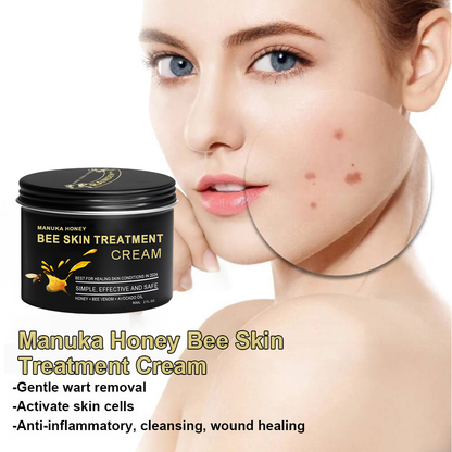 🏅👨‍⚕️Raindew™ Manuka Honey Bee Skin Treatment Cream🐝（AAD 𝑅𝑒𝑐𝑜𝑚𝑚𝑒𝑛𝑑𝑒𝑑） (🔥𝑳𝒂𝒔𝒕 𝒅𝒂𝒚 𝒑𝒓𝒐𝒎𝒐𝒕𝒊𝒐𝒏 7𝟎% 𝒐𝒇𝒇)