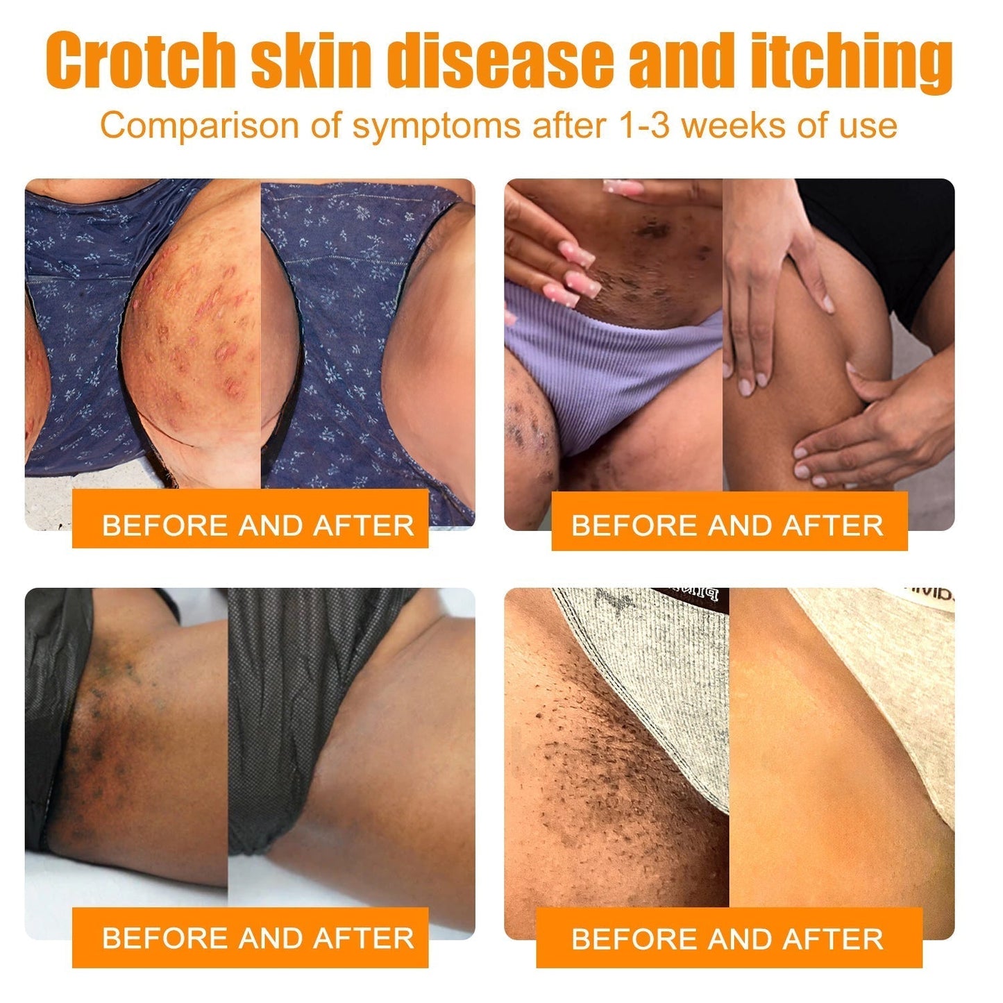 One Time Offer！Transform Your Health Today！We are offering you an additional 30% off! Dermatologist tested and completely cures all types of healthy in 3-6 weeks!